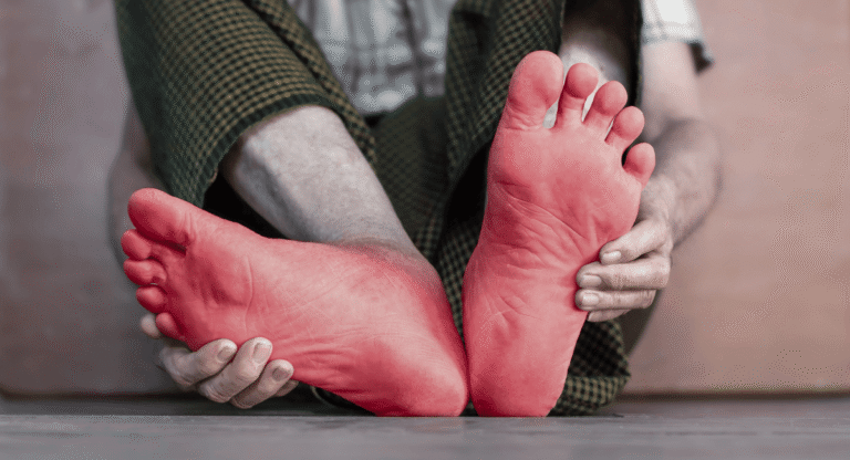Tingling Sensation in Feet? 5 signs in Feet You Shouldn’t Ignore